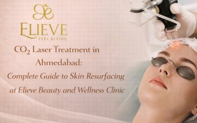 CO2 Laser Treatment in Ahmedabad