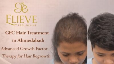 GFC Hair Treatment in Ahmedabad