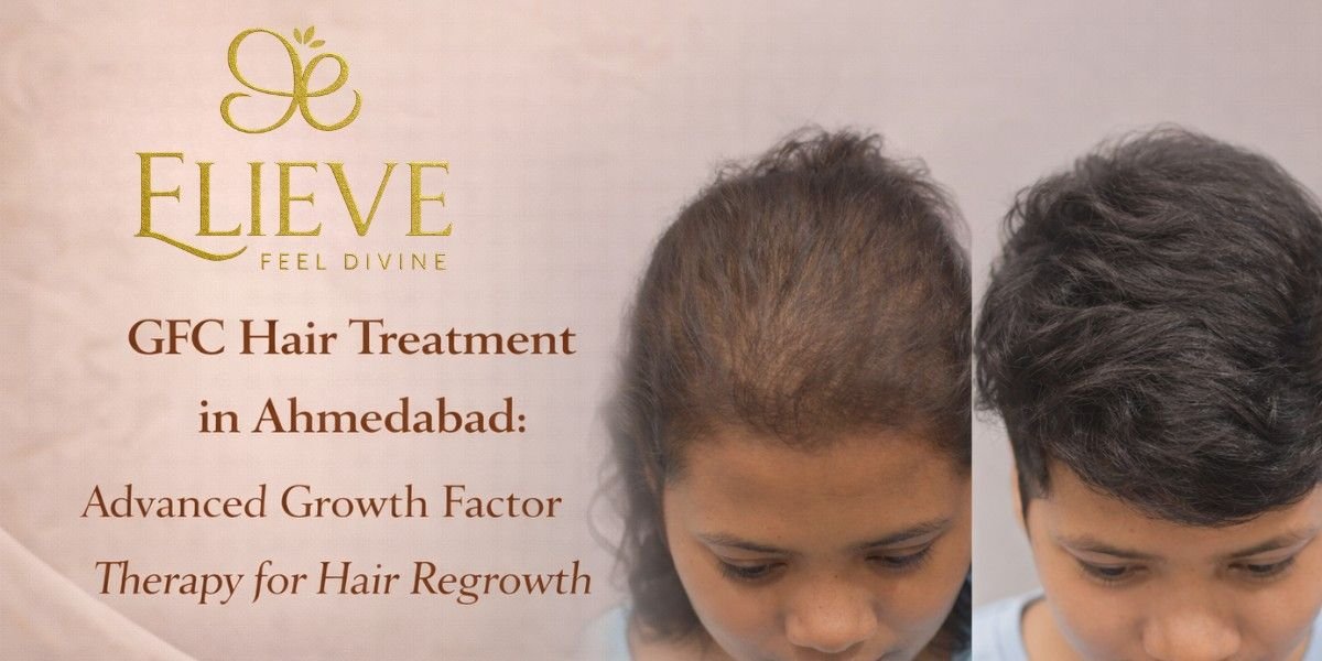 GFC Hair Treatment in Ahmedabad