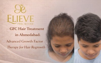 GFC Hair Treatment in Ahmedabad