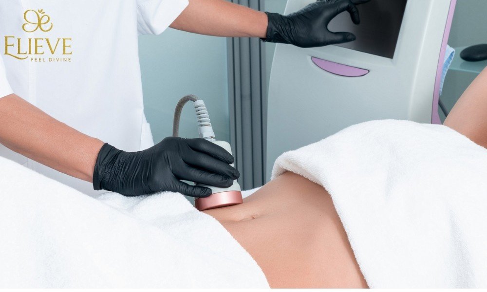 Laser Lipolysis Treatment in Ahmedabad