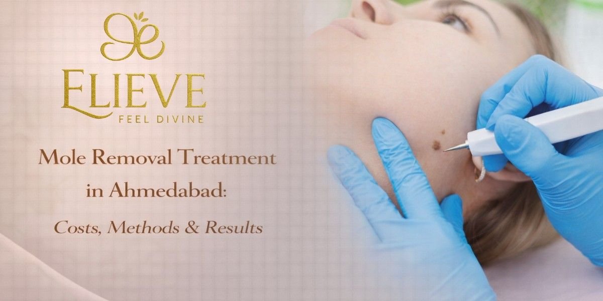 Mole Removal Treatment in Ahmedabad