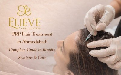 PRP Hair Treatment in Ahmedabad