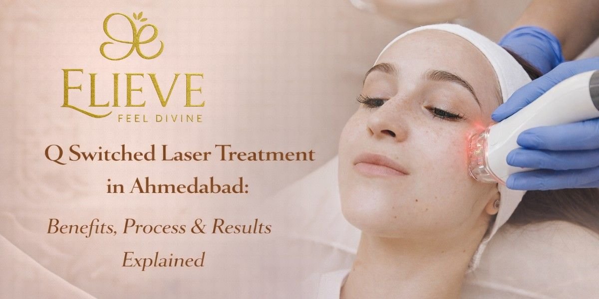 Q Switched Laser Treatment in Ahmedabad