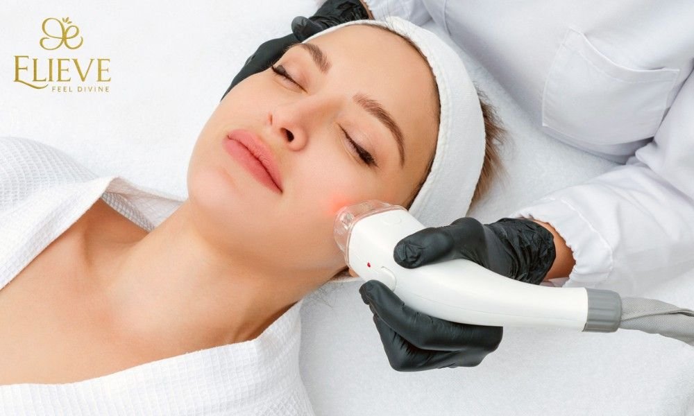 Q Switched Laser Treatment in Ahmedabad