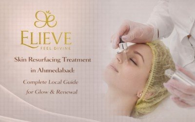 Skin Resurfacing Treatment in Ahmedabad