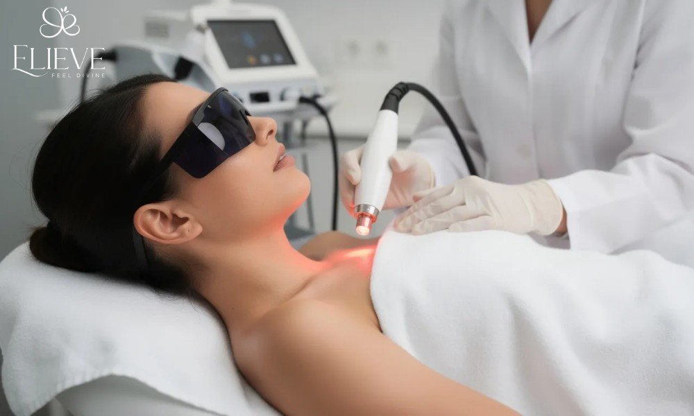 Skin Resurfacing and Epidermal