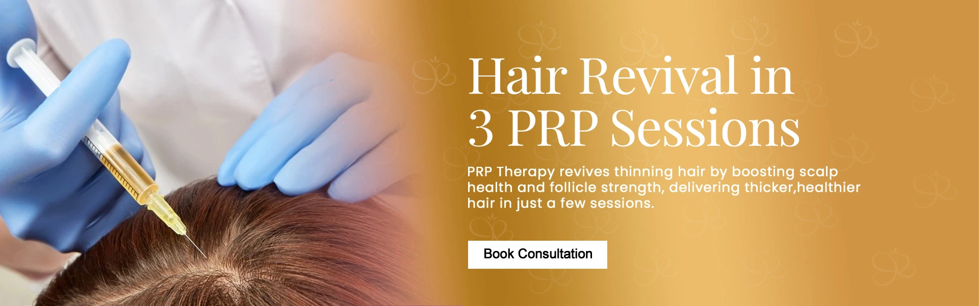 hair-prp-service.webp